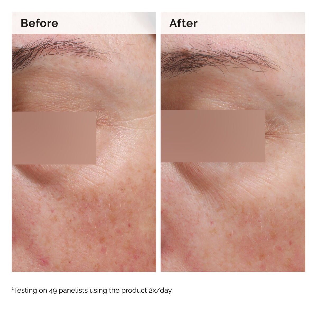 niacinamide-5-face-and-body-emulsion-o8 2024-08-23-ORD-Nia-5pct-Face-Body-B-A-Elasticity-Global-02-1x1.jpg