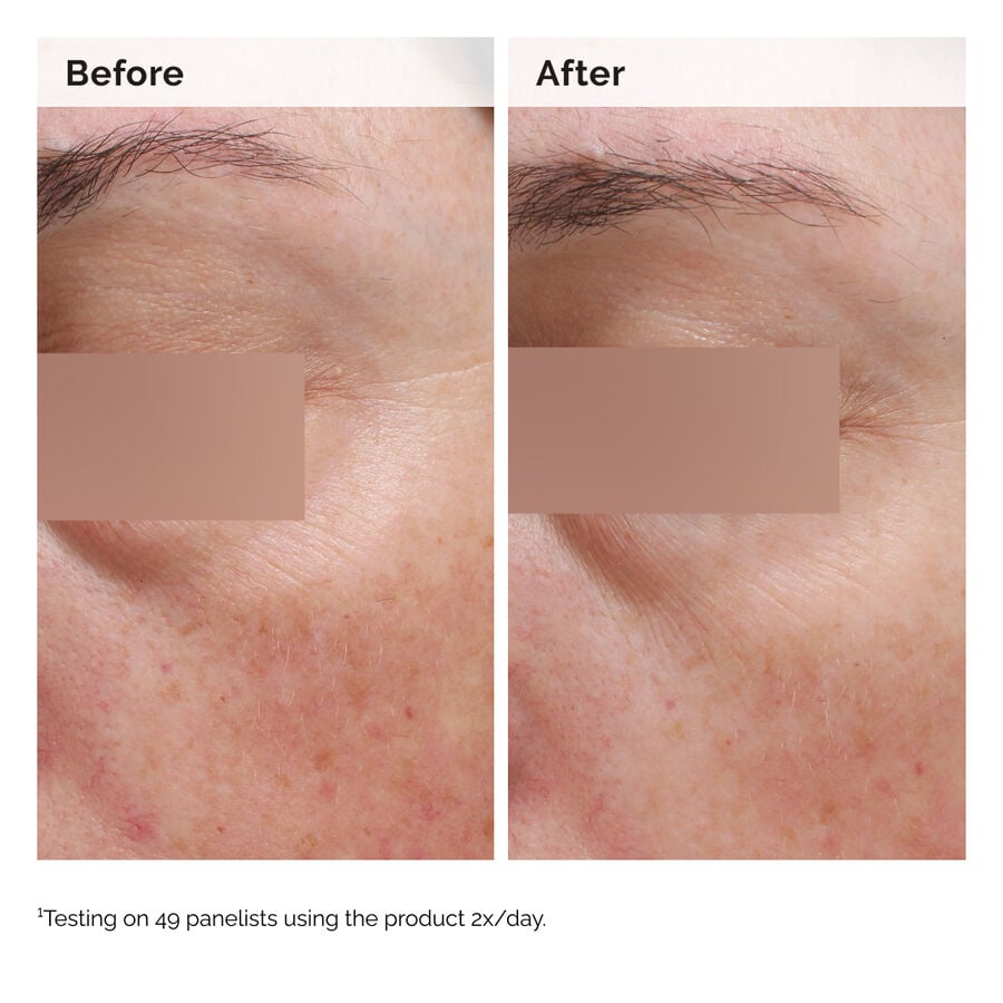 niacinamide-5-face-and-body-emulsion-o8 2024-08-23-ORD-Nia-5pct-Face-Body-B-A-Elasticity-Global-02-1x1.jpg