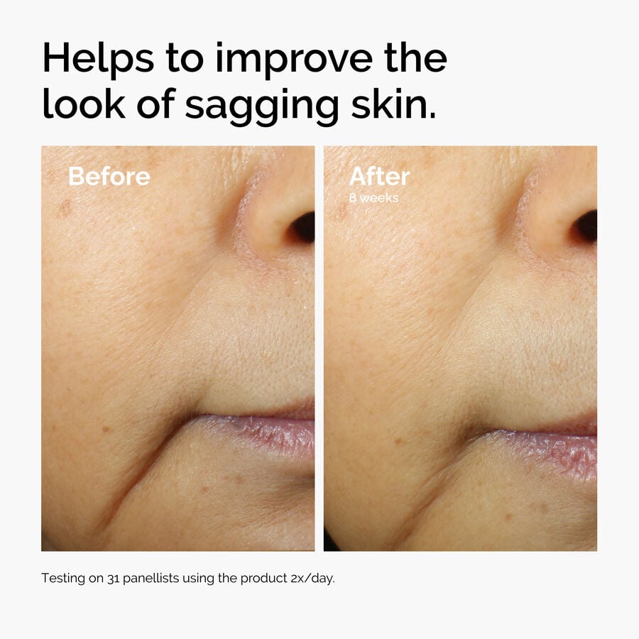 caffeine-3-escin-1-face-serum-l6 ord-caffeine-3pct-escin-1pct-face-serum-before-after-sagging.jpg