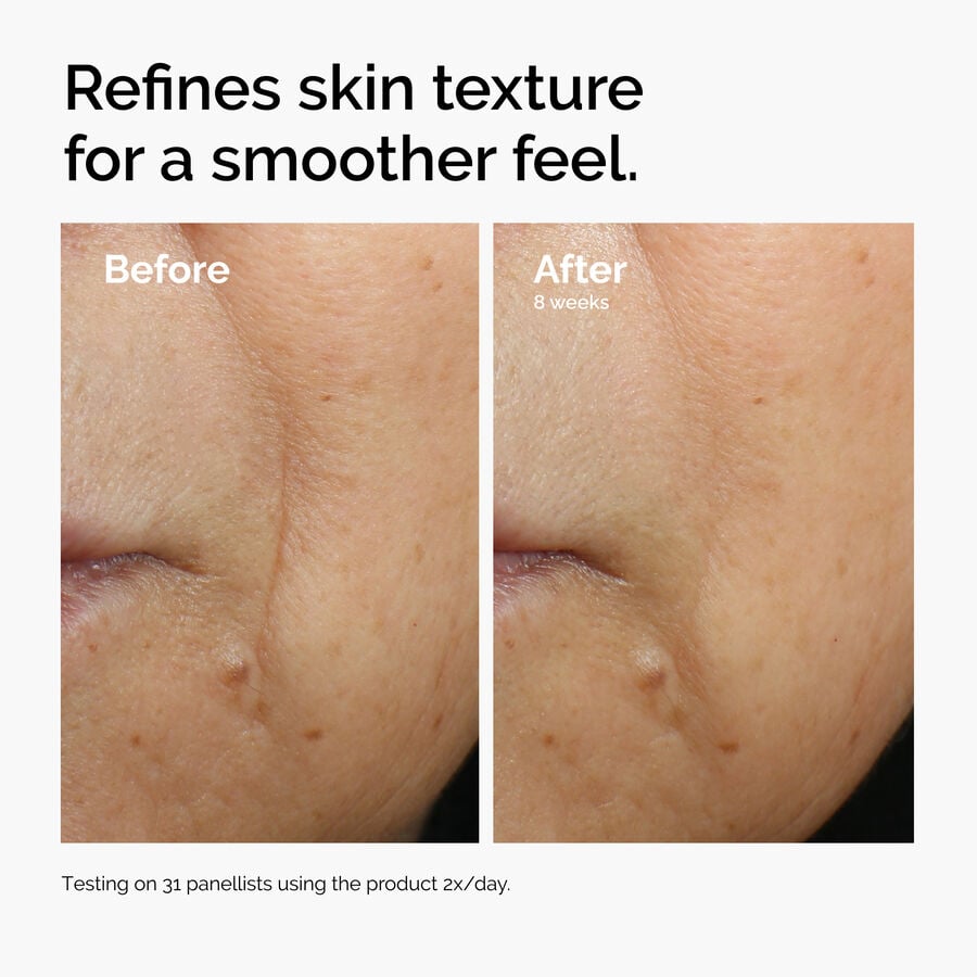 caffeine-3-escin-1-face-serum-l6 ord-caffeine-3pct-escin-1pct-face-serum-before-after-texture.jpg