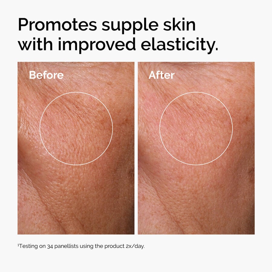 hyaluronic-acid-2-b5-with-ceramides-r2 ord-hyaluronic-acid-2pct-b5-hydrating-serum-before-after-elasticity.jpg