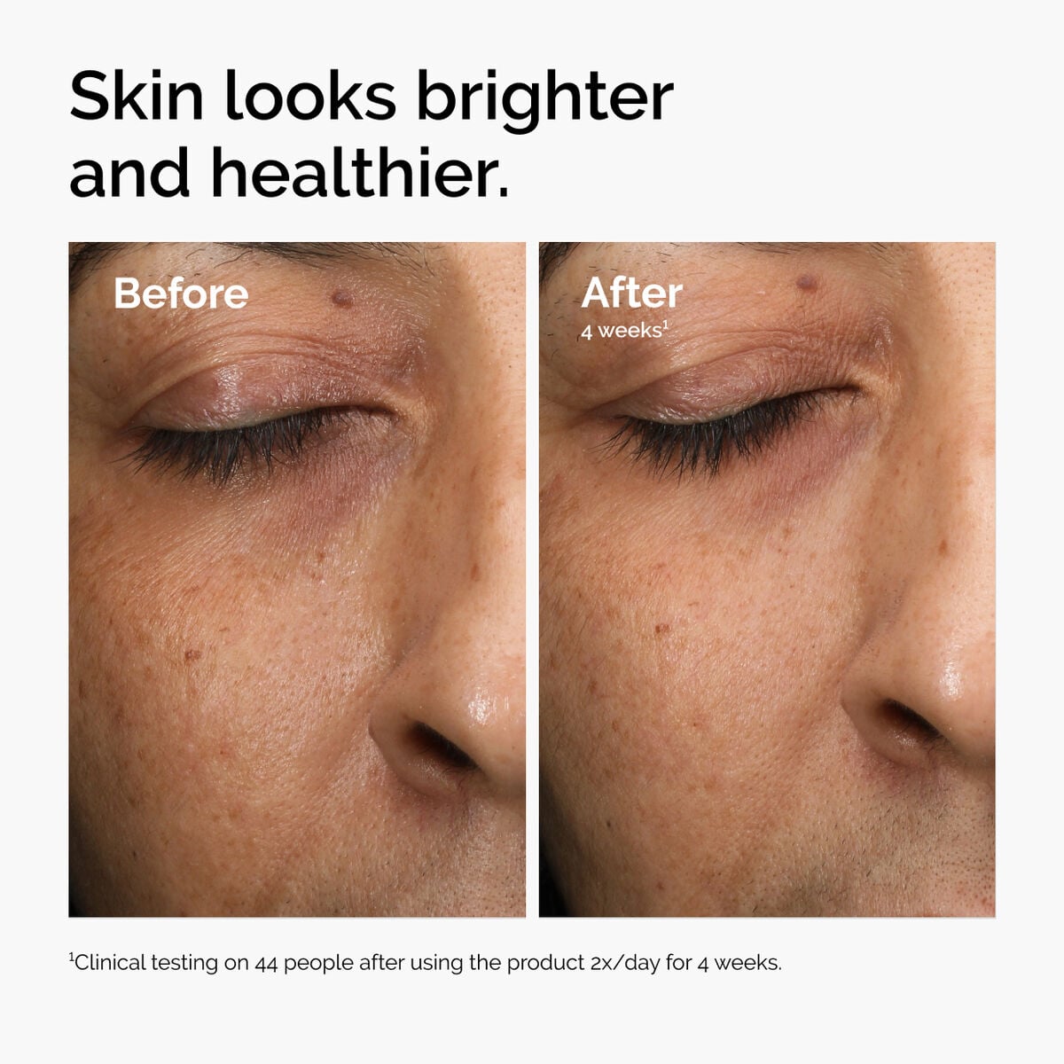 multi-antioxidant-radiance-serum-m1 ord-mars-before-after-healthy.jpg