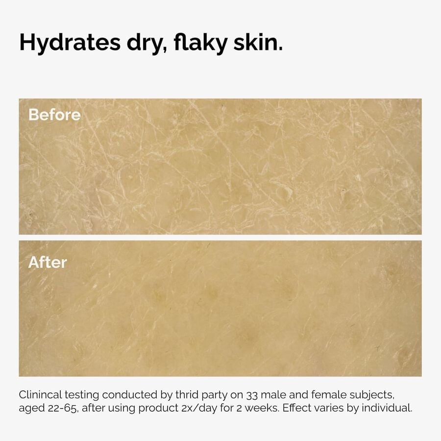 the-body-care-collection-b4 ord-natural-moisturizing-factors-inulin-body-before-after-graphic-02.jpg