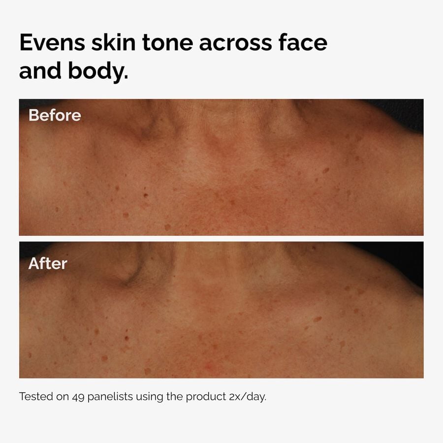 the-body-care-collection-b4 ord-niacinamide-face-body-serum-before-after-even-tone-graphic.jpg